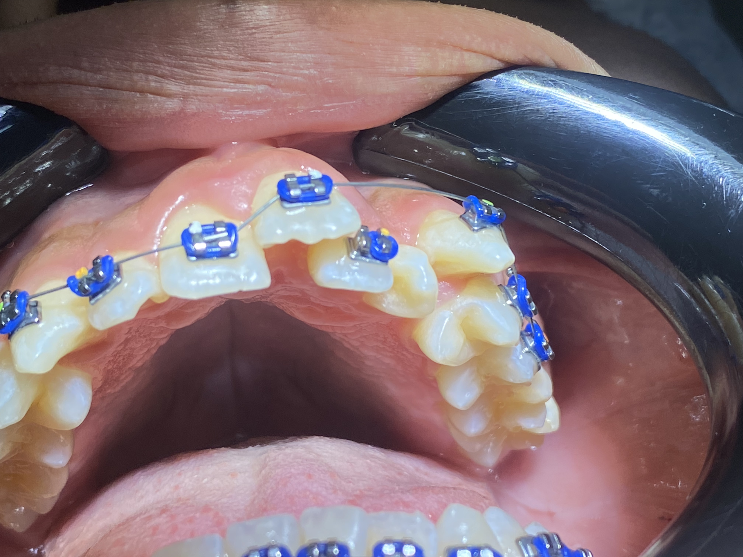 antes diego antes diego