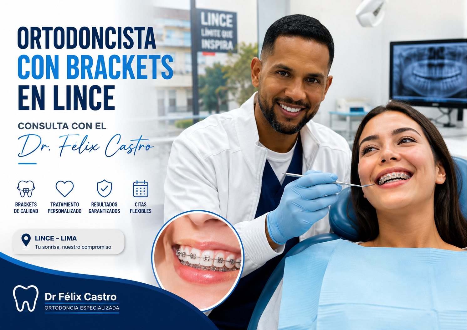 Ortodoncia especializada en Lince, Lima: brackets de calidad y tratamiento personalizado