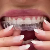 alineadores en lince